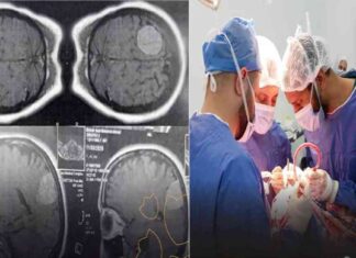 جراحة استئصال ورم بالمخ وتثبيت فقرات عنقية: نجاح عمليتين دقيقتين
