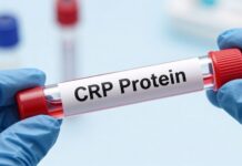 كيفية فهم تحليل CRP واهميته في تشخيص الالتهابات