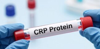 كيفية فهم تحليل CRP واهميته في تشخيص الالتهابات