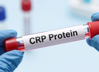 كيفية فهم تحليل CRP واهميته في تشخيص الالتهابات